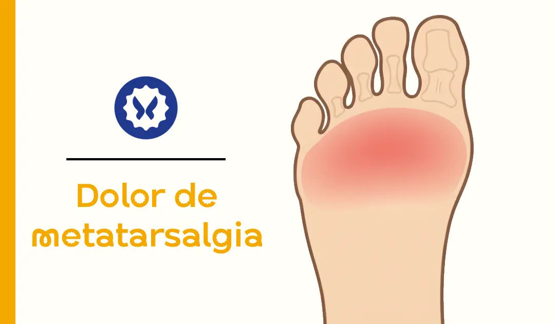Metatarsalgia: causas, síntomas, alivio y cómo elegir calcetines adecuados