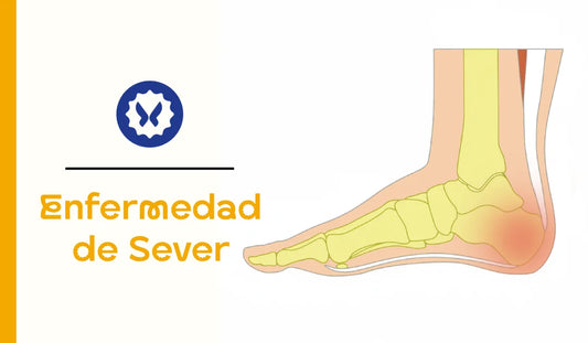Enfermedad de Sever, cómo aliviar